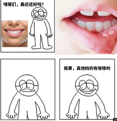 四格连环图，第一格顶部文字“嘿哥们，最近还好吗？”，左侧是真人微笑露齿的面部特写，右侧是简笔小人站立微笑；第二格为真人嘴巴特写，可见口腔内有明显溃疡；第三格仅简笔小人保持微笑站姿；第四格简笔小人旁配文“我草，真他妈的有够惨的”。通过友好问候与口腔溃疡的糟糕状况形成反差，用粗俗语言表达崩溃情绪，制造黑色幽默效果。