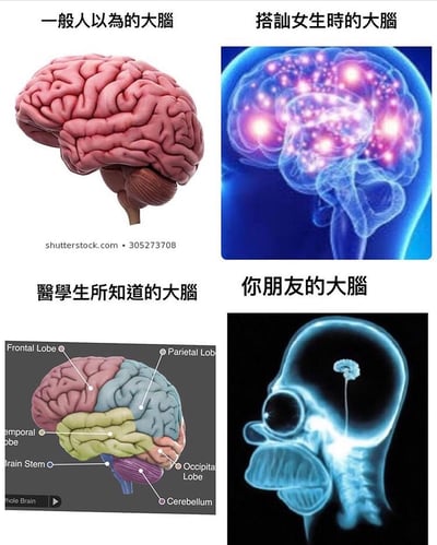 这是一张四格对比梗图，通过不同大脑图像幽默展示四种场景下的大脑状态：左上角为一般人认知中的真实大脑解剖图；右上角是搭讪女生时大脑活跃发光的夸张示意图；左下角是医学生视角下带详细分区标注（额叶、顶叶、颞叶等）的大脑结构图；右下角则是调侃朋友大脑的简化搞笑图像（仅一个小脑干连接）。整体通过对比制造幽默效果，反映不同身份或场景下对大脑的认知差异。