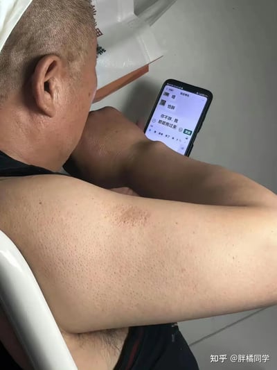 这张图片拍摄了一位大叔，他把手机夹在自己的腋窝和胳膊之间，看起来非常随意地用这种独特的方式在看手机上的微信。画面左下角能看到腋毛和胳膊的细节，手机屏幕上显示着微信聊天界面，能看到聊天对象昵称和部分对话内容。整个场景让人忍俊不禁，也给人一种“懒惰摆烂”的气质。一方面，这样的姿势体现了生活中的灵机一动，也暗含着对现代人“能躺就不坐，能坐就不站”的自嘲。

*无明显双关、谐音梗，但腋窝夹手机的举动本身具备视觉上的荒诞与反差感，极具网络传播趣味。*
