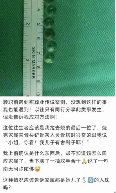 这张图为图文混排内容，上半部分是实拍画面：绿色斜纹布背景上放着一把印有“SKIN MARKER”字样的测量尺，尺子旁排列着六颗透明圆珠；下半部分是文字叙述，内容是一位即将转职的殡葬业工作人员分享的亲身经历：他负责火化的最后一位逝者的家属，将逝者生前体内植入的入珠误认为是佛门舍利子，十分兴奋地向他展示，他一时不知道该如何解释真相，情急之下双手合十念出“南无阿弥陀佛”，最后发文询问网友是否应该告知家属实情，内容反差感强烈，充满笑点。