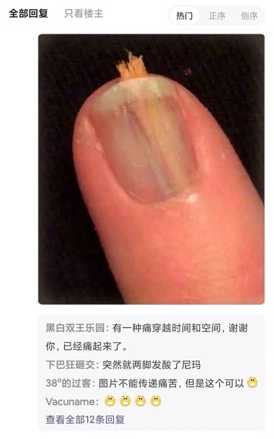 这是一张社交平台的截图，主体内容是一根手指的特写：指甲前端断裂，残留的指甲与甲床状态不佳，呈现出受伤后的视觉效果。下方是网友的评论区，多位网友表示看到这张图后产生了强烈的共情痛感，比如“有一种痛穿越时间和空间，谢谢你，已经痛起来了”“突然就两脚发酸了尼玛”，通过真实的受伤画面触发人们的生理共情，让看到的人都能联想到指尖受伤的剧烈疼痛，没有双关或谐音梗，完全依靠视觉画面引发共鸣。