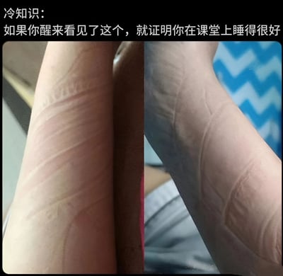 图片上方配有文字‘冷知识：如果你醒来看见了这个，就证明你在课堂上睡得很好’，下方是两张并排的手臂照片，左侧手臂上有明显的横向压痕，右侧手臂有类似书本或布料纹理的压痕，幽默地调侃学生在课堂上趴着睡觉时手臂被压出痕迹的经历，引发共鸣。