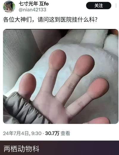 这是一张微博平台的社交媒体截图，用户@七寸光年（@nian42133）发布了一张经过图像编辑的手部照片，将手指修改成类似青蛙蹼爪的形态，配文向网友提问：“各位大神们，请问这到医院挂什么科？”。截图下方有一条搞笑回复：“两栖动物科”，通过调侃P图后的手类似两栖动物的肢体，制造出幽默的笑点。
这张图利用P图效果将人类手部伪装成动物肢体，搭配无厘头的提问和回复，形成趣味梗图，通过反差感制造笑点。