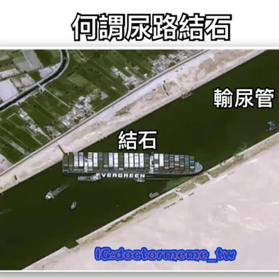 图片顶部以黑色粗体字标注“何谓尿路结石”作为标题，下方是一张航拍视角的照片，展示了Ever Given集装箱货轮横向卡在河道中的场景。货轮被标注为“结石”，河道两侧被标注为“输尿管”，通过货轮堵塞运河的直观画面，幽默类比尿路结石堵塞输尿管的医学现象，用生活化场景解释医学概念。