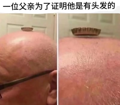 这是一张左右分栏的静态对比图，顶部配有文字“一位父亲为了证明他是有头发的”。左侧图展示了一位光头男性的头顶部分，能看到他佩戴的眼镜，头顶上方有一个小小的、类似短发茬的物件；右侧图是该头顶的特写，清晰显示出这个物件其实是一个类似蛋挞托的物品，被放置在光滑反光的光头上方，利用视觉错位的效果，制造出“这是他的头发”的假象，整体内容充满幽默反差感，用荒诞的方式调侃光头、脱发的趣味场景。