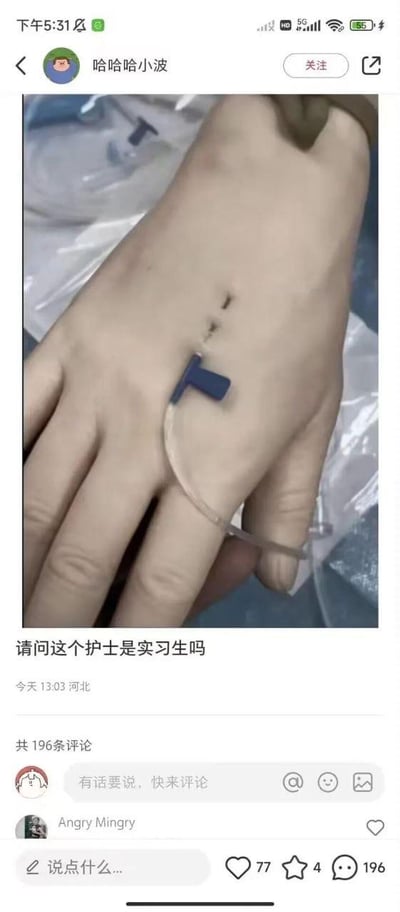 这是一张来自抖音平台的社交媒体截图，主图展示了一只手背：手背上有一处缝合后的伤口，同时贴着一个静脉留置针输液装置，由于位置巧合，视觉上看起来输液针的穿刺点在缝合伤口上，显得操作非常离谱。发布者配文“请问这个护士是实习生吗”，以调侃的语气质疑护士的操作水平，引发网友讨论。截图显示该动态由用户“哈哈哈小波”发布于当天13:03，定位河北，目前已有196条评论，界面底部有抖音的点赞、收藏、评论等互动按钮。实际上这是视觉错位造成的错觉，输液针并未扎在缝合伤口中，这种巧合的画面制造出了搞笑的吐槽点。