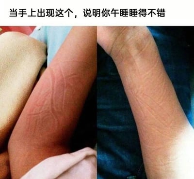 这是一张左右对比的静态真人图，左侧是压在浅色织物上的手臂，皮肤上清晰印出织物的纹路，手臂皮肤因长时间受压泛红；右侧是压在深色织物上的手臂，同样印出了织物的纹路。图片顶部配有文字“当手上出现这个，说明你午睡睡得不错”，以幽默的方式调侃午睡时睡得深沉，手臂长时间压在织物上留下明显压痕的状态，是引发打工人共鸣的趣味生活梗图，精准捕捉了午睡后的真实小细节。