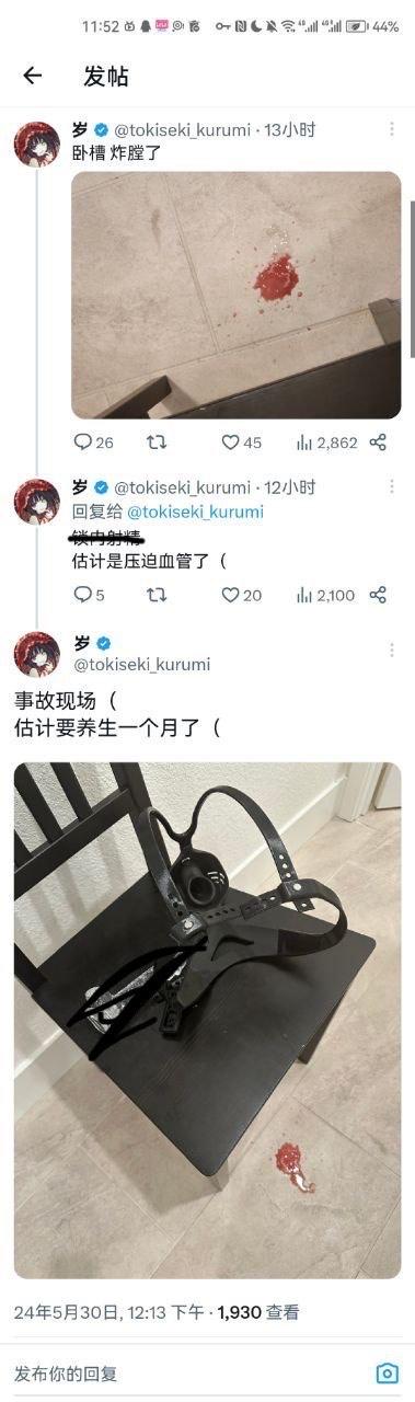 这是一组来自社交平台的用户动态截图，用户@tokiseki_kurumi（昵称“岁”）以连环发帖的形式分享自己的意外受伤经历：
1. 第一条动态配地面上的血迹图，用夸张的网络用语“卧槽 炸膛了”来形容自己突然出血的状况；
2. 随后用户自己回复这条动态，配文“估计是压迫血管了(”，推测出血原因是佩戴的装备压迫到了血管；
3. 最后一条动态发布了“事故现场”图：黑色的头部固定类装备放在黑色椅子上，地面还有残留的血迹，配文“事故现场（估计要养生一个月了（”，调侃自己需要长时间休养。
用户用“炸膛”这种原本形容枪械故障的词来夸张地描述自己出血的意外，显得诙谐又无奈。