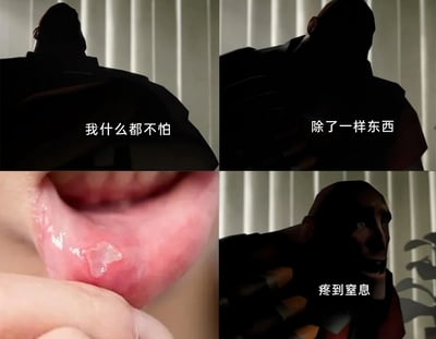 这是一组四格连环梗图，采用“硬汉反差”的搞笑手法：前两格展示《军团要塞2》中的重型武器士兵的剪影，配文“我什么都不怕”“除了一样东西”，塑造出无所畏惧的硬汉形象；第三格突然切入真实的口腔溃疡创面特写，揭示出“可怕的东西”是口腔溃疡；第四格展示重型武器士兵露出痛苦扭曲的表情，配文“疼到窒息”，用游戏中强大的角色被口腔溃疡击败的反差感，调侃口腔溃疡带来的剧烈痛感，引发有过相同经历的观众的强烈共鸣。