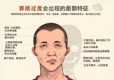 这是一张关于所谓"邪淫过度会出现的面部特征"的伪科学图解，图中展示了一个男性头部侧面肖像，并在面部不同位置标注了多种所谓的"纵欲者面部特征"，包括脱发、抬头纹、三白眼、颧骨突出等。图片上方有红色标题文字，下方有详细的文字说明，声称这些面部特征与手淫和纵欲有关，带有明显的伪科学和道德说教性质。
