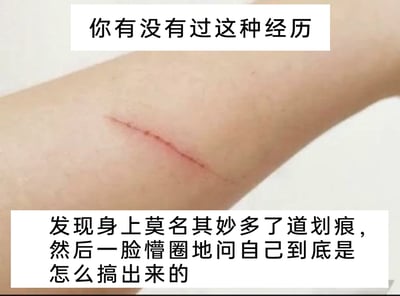 这是一张引发生活共鸣的图文混排梗图，画面主体是一段带有红色细长划痕的人体手臂，上下方各有一个白色文字框，上方文字框写着“你有没有过这种经历”，下方文字框写着“发现身上莫名其妙多了道划痕，然后一脸懵圈地问自己到底是怎么搞出来的”。图片通过结合实拍的划痕照片和贴近日常的文字，精准描述了生活中很多人都有过的迷惑经历：身上突然出现不明来源的小划痕，自己却完全想不起是如何造成的，以此引发大众的共鸣，用轻松搞笑的方式调侃这种常见的小疑惑。