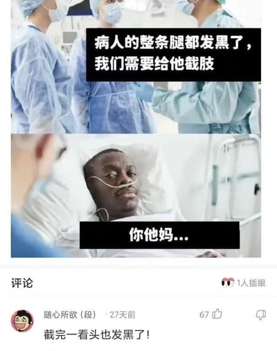 这张梗图分两部分，上半部分医生们讨论说病人的整条腿都发黑了，要给他截肢，下半部分病人无语地回复“你他妈……”，再有评论区玩梗：“截完一看头也发黑了！”整体以幽默夸张方式吐槽医疗误会，带有黑色幽默与网络玩笑。图中存在一定的谐音与双关（“发黑”既指病症，也暗指肤色），适合用来调侃“误诊、无语”等场景。