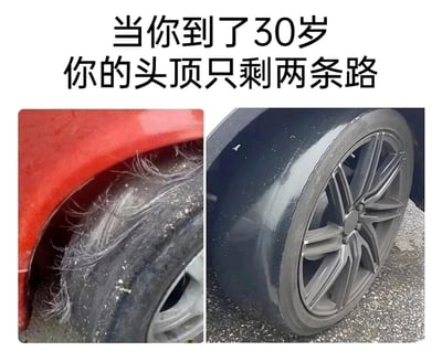 这是一张带有调侃性质的左右对比梗图，顶部配有文字“当你到了30岁 你的头顶只剩两条路”。左侧展示了一个磨损严重、胎面处长出大量类似灰白色杂乱毛发的汽车轮胎，以此类比30岁人群头发稀疏、发量堪忧，毛发杂乱稀疏的脱发状态；右侧则是一个胎面光滑、如同光头的汽车轮胎，对应30岁人群因脱发直接选择剃光头的结局。图片通过将汽车轮胎的两种极端状态与人类头顶发量进行谐音类比，夸张地调侃当代人到30岁普遍面临的脱发困境，用幽默的方式引发同龄人的共鸣。