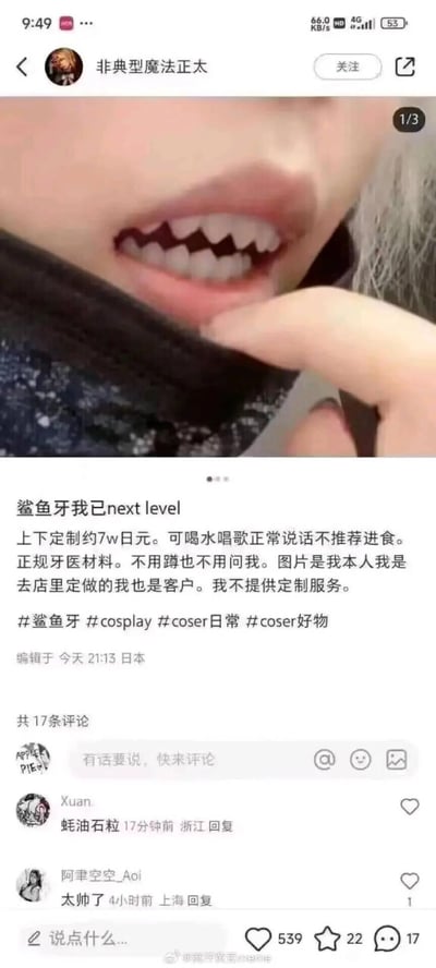 这是一条来自日本的社交平台分享内容，博主展示了自己定制的上下鲨鱼牙假牙，配文称自己的鲨鱼牙造型已经达到新高度。文中说明该定制假牙花费约7万日元，采用正规牙医材料制作，可正常喝水、唱歌、说话，但不推荐用于进食，同时明确表示自己只是定制服务的客户，不提供定制相关服务。评论区有网友用谐音梗“蚝油石粒”（谐音“好离谱”）调侃这个独特的鲨鱼牙造型，还有网友称赞造型帅气。