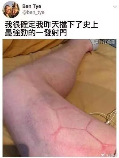 这是一张推特（X平台）用户Ben Tye发布的社交媒体截图，图中展示了他的腿部，腿上的红色瘀伤纹路和足球的纹路高度相似，配文“我很确定我昨天擋下了史上最強勁的一發射門”，用夸张的幽默手法，将腿部的特殊伤痕和足球运动里挡射门的场景结合，制造出搞笑的玩梗效果。图中还附带了中文翻译标识“譯:好色龍”，右下角有微博账号“@没品图”的水印，说明该内容被汉化后搬运到国内社交平台进行传播。