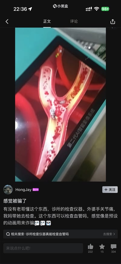 社交媒体截图显示，用户HongJay在小黑盒APP发帖质疑诊所检查仪器。图片中平板电脑屏幕展示了一段血管内部动画，红色血流和红细胞清晰可见，标注'第二代AI智能系统'。用户配文称外婆因关节痛在诊所接受检查，怀疑该设备通过预设动画进行诈骗，询问网友是否了解此类仪器。整体内容反映了对医疗检查设备真实性的警惕和对老年人可能被误导的担忧。