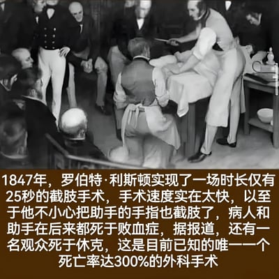 这是一幅黑白历史插画，描绘了1847年罗伯特·利斯顿进行快速截肢手术的场景。画面中有多名穿着19世纪服饰的男性围绕在手术台周围，主刀医生正专注于手术操作，周围有助手和围观者。图片下方配有文字说明，讲述了这场仅用25秒完成的截肢手术因速度过快而导致的意外后果：医生不小心截掉了助手的手指，病人和助手后来都死于败血症，还有一名观众死于休克，形成了300%的死亡率这一历史奇闻。