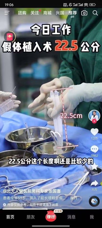 这是一张抖音平台的视频截图，呈现北大人民医院男科专家张国喜团队的阴茎假体植入手术相关场景。画面中医护人员戴着无菌手套，手持长度达22.5cm的延长增粗型假体，图中用红色标线标注出假体的长度数值。配文说明这是为53岁患者进行的手术，同时强调22.5公分的假体长度比较少见。截图保留了抖音的界面元素，包括顶部的“团购、关注、商城”等导航栏，右侧的作者头像、点赞（1.2万）、评论（3852）、转发（7.1万）等互动按钮，底部的“首页、朋友、赚钱”等功能栏，以及页面底部的“内容仅供参考，如有不适请线下就医”的提示文字。图中无任何双关、谐音梗或暗示类内容。
