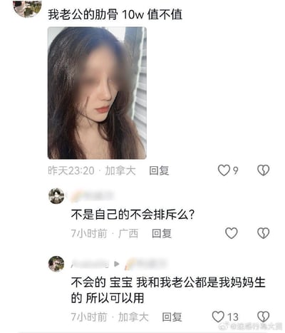 这是一张海外社交平台的对话截图，楼主发布了自己的马赛克处理照片，配文询问“我老公的肋骨 10w 值不值”，暗示自己使用丈夫的肋骨进行整形手术，花费10万元。有网友疑惑异体肋骨是否会产生排异反应，楼主却回复称不会，理由是“我和我老公都是我妈妈生的”，这个混淆亲属关系的荒谬逻辑让人感到迷惑无语。