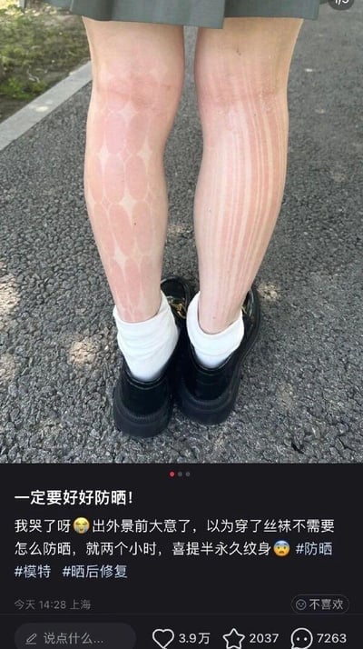 这是一张竖屏格式的社交媒体分享截图，画面上半部分展示了一位女生的双腿，由于她穿了镂空设计的丝袜却未做好充足防晒，在户外仅待了两小时，腿部皮肤就被晒出了与丝袜纹路完全一致的色差：未被丝袜遮挡的区域被晒黑，丝袜覆盖的区域保留原本肤色，左腿呈现菱形镂空丝袜的晒痕，右腿呈现竖条纹镂空丝袜的晒痕，形成了类似“半永久纹身”的视觉效果。画面下半部分是博主的配文内容，她用崩溃无奈的语气吐槽自己的疏忽，呼吁大家一定要好好防晒，并带上了相关话题标签，提醒其他网友注意防晒和晒后修复。