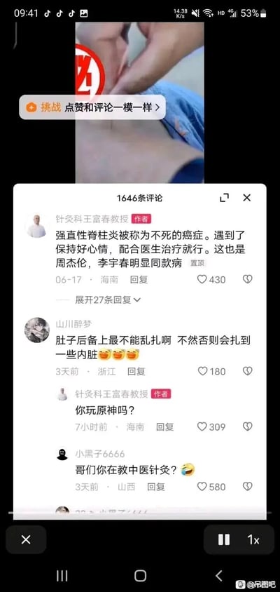 这是一张抖音平台的视频评论区截图，视频内容为中医针灸相关。博主“针灸科王富春教授”置顶评论介绍强直性脊柱炎，提及周杰伦、李宇春也患有同款病症；网友“山川醉梦”评论提醒肚子和后背不能乱扎针灸，避免扎到内脏，博主却意外回复“你玩原神吗？”，出现完全答非所问的搞笑错位；网友“小黑子6666”随即调侃“哥们你在教中医针灸？”，整个评论区因博主的错位回复充满滑稽氛围，成为搞笑梗图被分享。