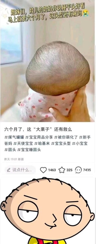 这是一张上下拼接的趣味内容图，上半部分是国内社交平台（推测为小红书）的用户发帖截图：一位宝妈因宝宝被奶奶坚持睡平头，导致六个月大的宝宝头型变成上窄下宽的扁平样式，酷似“大栗子”，于是发帖求助其他网友宝宝的头型是否还能矫正，帖子附带了相关育儿标签，显示发布于新疆，还有1463个点赞、325个收藏、7435条评论；下半部分是美国动画《恶搞之家》中的角色斯图尔特·格里芬的卡通形象，该角色标志性的窄上宽下的头型与宝宝的头型高度重合，形成了搞笑的呼应，放大了宝妈分享内容的趣味性。针对宝妈的问题，六个月的宝宝头骨尚未完全钙化定型，是可以通过调整睡姿（交替侧睡、仰睡，避免长期压同一部位）、使用适合月龄的定型枕，或在专业医生指导下进行矫正训练，来逐步改善头型的。