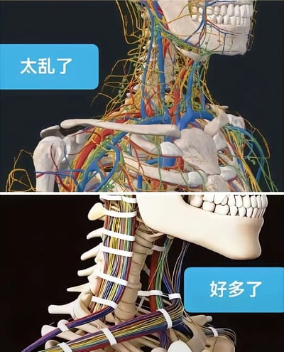 图片分为上下两部分，均为人体颈部及肩部的3D解剖模型。上半部分模型中，神经、血管等组织结构呈现杂乱无章的缠绕状态，左上角蓝色文本框标注“太乱了”；下半部分模型中，相同的组织结构被白色束带整齐捆绑排列，右下角蓝色文本框标注“好多了”。通过鲜明对比直观展现了混乱与有序的视觉差异，常用于幽默表达对杂乱状态的吐槽及对整洁状态的认可。