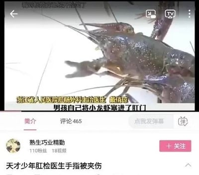 这是一张短视频平台的截图，上方视频画面展示了一只小龙虾，配文说明是浙江省人民医院肛肠外科的医生讲述男孩将小龙虾塞进肛门的医疗事件；下方是评论区，用户“熟生巧业精勤”留下评论“天才少年肛检医生手指被夹伤”，玩了一个双关梗，调侃医生为男孩做肛检时被留在肛门里的小龙虾夹伤，将严肃的医疗事件转化为荒诞搞笑的段子，制造出反差幽默的效果。
