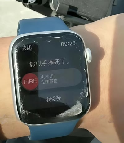 一张智能手表的特写照片，手表屏幕已严重碎裂，显示着幽默的错误通知："您似乎摔死了。" 下方有一个红色的"FIRE"按钮，标注"火葬场 立即联络"，以及一个"我没死"的选项。手表佩戴在人的手腕上，背景隐约可见车内环境。