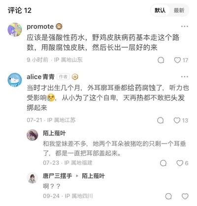 这是一张社交媒体评论区截图，共显示4条评论，讨论关于耳部损伤和药物治疗的话题。有用户提到强酸性药水治疗皮肤病的原理，作者分享了自己婴儿时期用药导致外耳廓和耳垂被腐蚀、听力受影响并因此自卑的经历，还有用户讲述了堂妹耳朵被猪咬伤的类似遭遇。评论中充满了对这些不幸经历的同情和关切。
