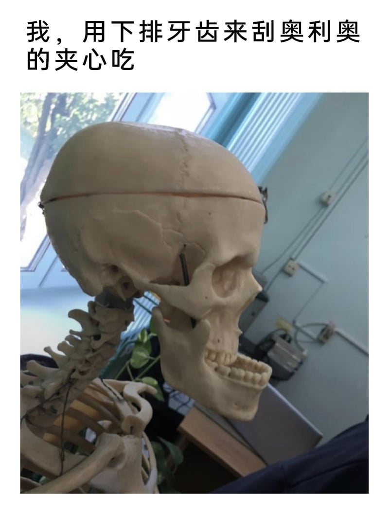 医学教学模型