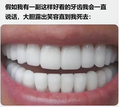 图片上方配有文字“假如我有一副这样好看的牙齿我会一直说话，大胆露出笑容直到我死去：”，下方是一张特写的牙齿照片，牙齿洁白整齐，视觉冲击力强。整体通过夸张的语气表达了对拥有美观牙齿的强烈渴望，带有幽默调侃的意味。
