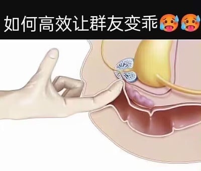 这是一张无厘头搞笑整活梗图，上方配有文字“如何高效让群友变乖”和两个流汗惊恐的表情，下方是医学专业图示，展示了戴手套的手按压男性睾丸的动作。图中用生理上的剧烈疼痛作为夸张的“威胁”手段，来对应“让群友变乖”的说法，属于戏谑式的反差梗，通过夸张的生理惩罚场景，调侃群管理整治活跃群友的需求，用搞笑的方式制造荒诞的反差感。