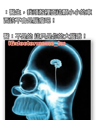 这张梗图上方是患者和医生的对话，患者担心自己头里的小东西是脑瘤，医生则幽默地指出那只是他的大脑。下方是辛普森一家角色荷马·辛普森的头部X光图像，夸张地显示了一个非常小的大脑，形成搞笑的视觉效果。