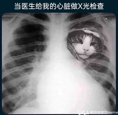 这是一张经过创意P图改编的趣味梗图，画面主体是一张人类胸部X光片，但原本心脏的位置被替换成了一只表情平静的猫咪，上方配文“当医生给我的心脏做X光检查”。图片以幽默的拟人化方式，表达了创作者作为“猫奴”，将猫咪放在自己心中最重要位置的喜爱之情，风格可爱搞笑，很容易引发宠物爱好者的共鸣。