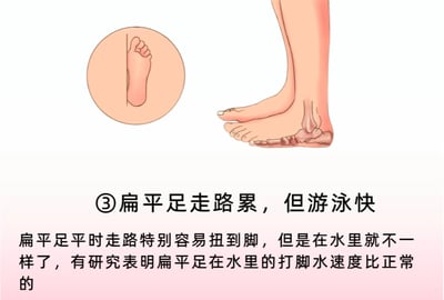 图片为一张关于扁平足特征的科普图解，左侧有圆形放大图展示扁平足的足部结构，右侧为腿部和足部的侧面示意图。上方标题文字标注“③扁平足走路累，但是游泳快”，下方详细说明扁平足在行走时易扭脚，但水中打脚速度更快的特点，并提及研究支持这一结论。整体采用图文结合方式，直观呈现扁平足的生理特性及利弊。