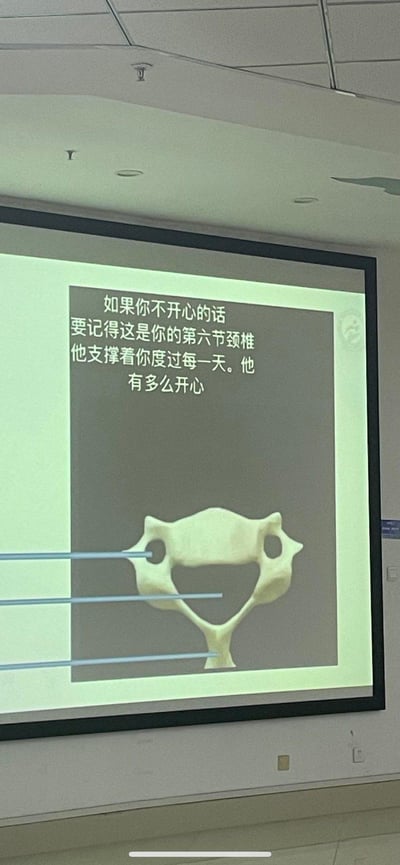 这是一张兼具医学元素与治愈属性的趣味图文，上方配有暖心文案：“如果你不开心的话 要记得这是你的第六节颈椎 他支撑着你度过每一天。他有多么开心”，下方展示的是人体第六节颈椎的3D渲染模型，这个骨骼的形态巧合地呈现出咧嘴大笑的面部模样，通过拟人化的手法，将原本严肃的医学素材转化为治愈情绪的趣味内容，用这种反差感来安慰情绪低落的人，传递温暖的情绪价值。