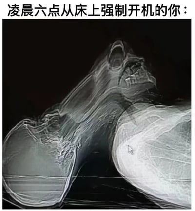 这张梗图通过一张类似X光片的黑白图像，幽默地表现了人们清晨被强行唤醒的状态。图片上方配有文字"凌晨六点从床上强制开机的你："，下方是一张看起来像是机械结构或骨骼的X光图像，整体营造出一种身体像机器一样被强制启动的搞笑效果。