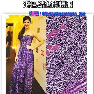 這是一張左右對比的幽默迷因圖，左側是一位女性身穿紫色無肩帶禮服叉腰站立的照片，右側是顯微鏡下的淋巴結組織切片圖像。圖片通過將禮服上的花紋與淋巴結顯微圖像進行視覺對比，創造出「淋巴結低胸禮服」的雙關幽默效果。