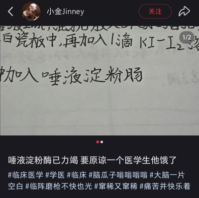 整张图是社交平台动态截图，上半部分展示了手写的生物或化学实验步骤内容，书写者本该填写实验材料「唾液淀粉酶」，却因备考疲惫走神错写成了食品「唾液淀粉肠」；下半部分是发布者的配文，调侃称「唾液淀粉酶已力竭 要原谅一个医学生他饿了」，还附带了多个和医学生备考相关的话题标签，整体风格诙谐搞笑，生动呈现了学生备考时精神疲惫、注意力不集中容易写错字的状态，很容易引发学生群体的共鸣。