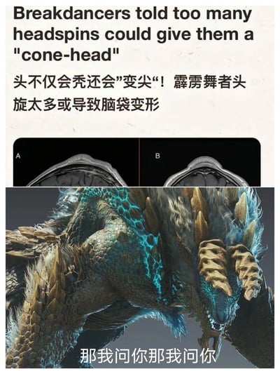 这是一张拼接类搞笑meme，上半部分是关于霹雳舞者的科普图文，英文与中文文字说明“霹雳舞者做太多头旋会导致脑袋变形成锥头”，并配有A、B两张脑部扫描对比图，B图显示头部呈现尖锥形态；下半部分是卡普空《怪物猎人》系列中的经典怪物雷狼龙，配文“那我问你那我问你”，玩梗雷狼龙天生的尖锥状头部，仿佛在质问自己是不是也因为“头旋太多”才变成这样，将科普内容与游戏角色外形结合，制造戏谑搞笑的效果。