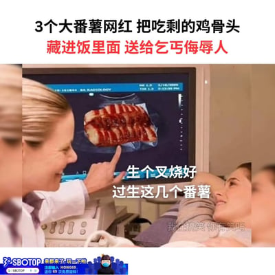 图片是一张恶搞合成梗图，背景为医生在做超声波检查的医疗场景，屏幕显示正常应该是B超影像，但画面被P成了一块裹有酱料的鸡骨头。图片上方大字描述了“三个大番薯网红把吃剩的鸡骨头藏进饭里面送给乞丐侮辱人”，显然是在讽刺网络上的某些行为，幽默嘲讽了一些短视频网红通过“作秀”行为造热点。图片的幽默之处在于将鸡骨头P进B超里，明显是对网红捐赠的假慈善行为做出夸张揶揄。