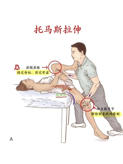 这是一张托马斯拉伸动作的教学插图，展示了一名被拉伸者仰卧在床，另一名辅助者协助进行拉伸的场景。图中用红色箭头和圆圈标注了关键动作步骤，包括“屈髋屈膝”“稳定脊柱、固定骨盆”“伸直膝关节”“解除股直肌的限制”，并对“腰腰肌”位置进行了红色高亮标注，整体为清晰的教学图解风格。