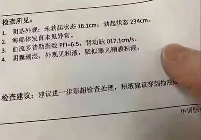 一张疑似医疗检查报告的截图，内容显示阴茎外观测量数据异常夸张，未勃起状态16.1cm，勃起状态竟达234cm（约2.34米），明显超出人类生理极限。报告还包含海绵体发育、血流多普勒指数等医学术语描述，底部有检查建议内容。右下角有一根手指指向报告文字。这显然是一张经过恶搞修改的图片，通过编造离谱的医学数据制造幽默效果。