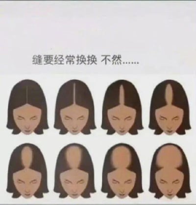 这是一张图文混排的连环静态图，上方配有提示文字“缝要经常换换 不然……”，下方通过8张卡通人物头像的递进展示，以夸张的手法呈现长期固定同一个发型分缝的后果：从最初正常的分缝，到分缝处头发逐渐稀疏、分缝宽度不断变大，最后头顶大部分头发脱落，几乎秃顶。图中卡通人物的表情也随着头发的减少逐渐变得无奈，用幽默搞笑的方式，生动地提醒人们经常更换发型分缝位置的重要性，避免因长期拉扯同一区域头发导致局部脱发。