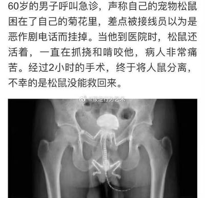 这是一张图文混排的猎奇内容图，上方是一段荒诞的文字描述：60岁男子呼叫急诊，称宠物松鼠困在自己的肛门（俗称菊花）里，差点被接线员当成恶作剧电话挂断。男子到院时松鼠还活着，一直在抓挠啃咬他，让他十分痛苦，经过2小时手术完成人鼠分离，但松鼠没能存活。下方是一张X光片，显示松鼠位于人类骨盆区域，四肢张开，直观呈现了文字描述的荒诞场景，整体内容充满猎奇感和荒诞的搞笑氛围，不存在双关、谐音梗或暗示内容。