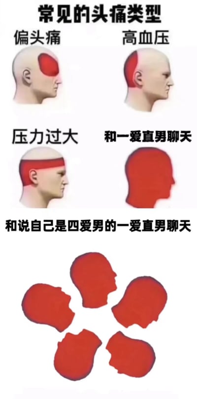 这是一张以“常见的头痛类型”为主题的搞笑图文拼接梗图，通过医学风格的头部侧面示意图（红色区域标注疼痛位置），从左到右、从上到下展示不同场景下的头痛程度。

- 第一行左侧“偏头痛”：头部左侧太阳穴区域红色；
- 第一行右侧“高血压”：头部后侧红色；
- 第二行左侧“压力过大”：头部前额至后脑勺横向红色条带；
- 第二行右侧“和一爱直男聊天”：整个头部全红；
- 第三行“和说自己是四爱男的一爱直男聊天”：五个碎片化的红色头部轮廓呈放射状排列，夸张表现“头痛炸裂”。

图中通过将医学常识与网络社交梗（“一爱”“四爱”为网络流行的恋爱模式分类）结合，用疼痛区域的扩大和形态变化制造递进式幽默，调侃与特定类型男性聊天时的无奈体验。