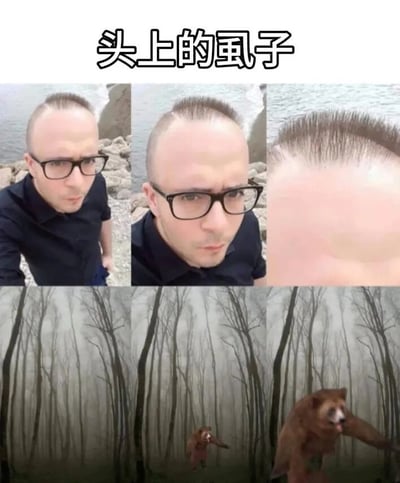 图片上方有文字“头上的虱子”，整体分为上下两排共六张图片。上排三张为同一男性的头部特写：第一张展示其头顶头发稀疏的状态，背景有水域和石头；第二张更近一步聚焦头顶，稀疏感更明显；第三张是头顶发际线的超近特写，可见头发根部。下排三张为森林场景：第一张是只有光秃秃树木的森林；第二张在树林远处出现一只熊；第三张熊从树林中跃起，姿态凶猛。通过头发稀疏的特写与熊逐渐逼近的动态形成幽默对比，暗喻“头上的虱子”可能像熊一样“活跃”或稀疏头发的视觉联想。