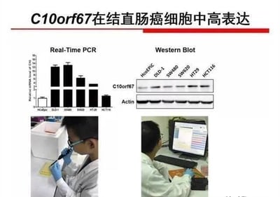 这是一张多图拼接的图文混排科研展示图，用于呈现C10orf67基因在结直肠癌细胞中高表达的实验结论。上方左侧是Real-Time PCR实验的柱状图，对比了HCoEpiC正常肠上皮细胞与DLD-1、SW480等多种结直肠癌细胞系中C10orf67的相对mRNA表达量，显示该基因在结直肠癌细胞系中表达量远高于正常细胞；上方右侧是Western Blot实验结果图，通过蛋白检测验证了C10orf67蛋白在上述细胞系中的表达情况，Actin作为内参蛋白保证实验可靠性。下方两张实拍照片展示了科研人员的工作场景：左侧是科研人员戴手套手持移液器进行实验操作，右侧是科研人员面对电脑分析实验数据，整体内容严谨，清晰呈现了基因表达研究的实验数据与科研过程。