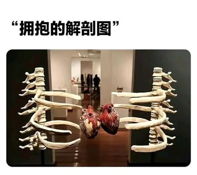图片展示了一件名为“拥抱的解剖图”的雕塑作品，位于艺术画廊展厅内。雕塑主体由两具白色脊柱模型构成，它们的肋骨部分相互伸展，呈现出拥抱的姿态，两具模型中央各有一颗红色心脏，彼此靠近仿佛相互触碰。背景可见画廊的内部环境，透过玻璃能看到远处的参观者和其他展品。图片顶部有黑色引号标注的标题文字“拥抱的解剖图”。